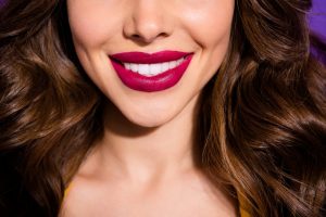 smile makeover