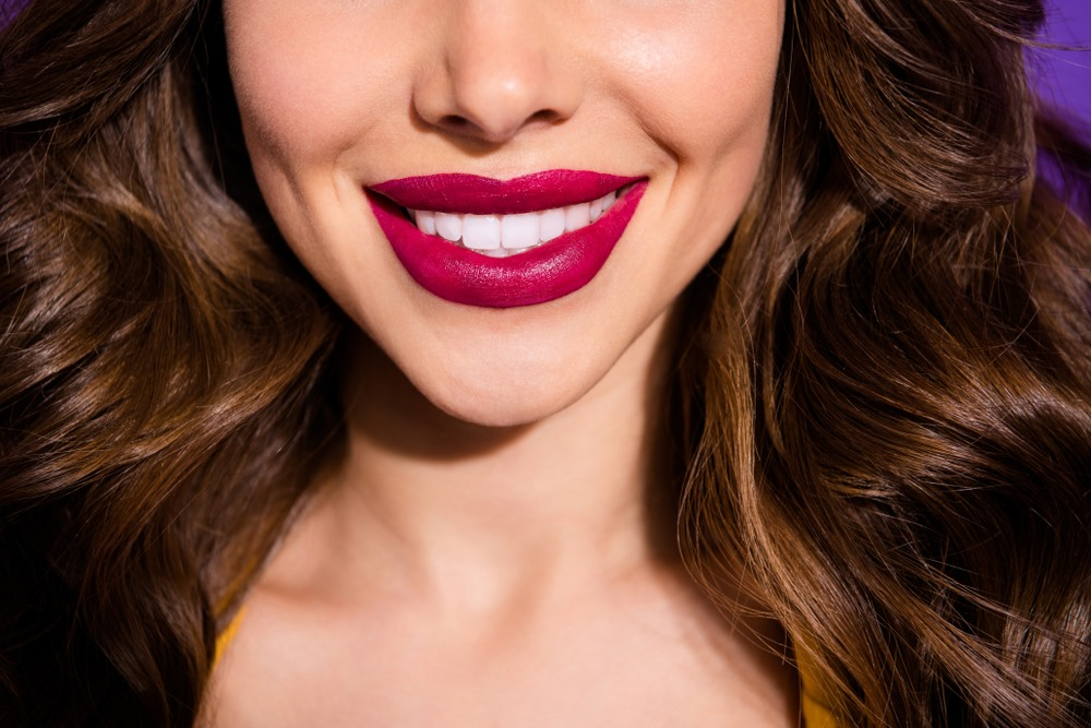 smile makeover